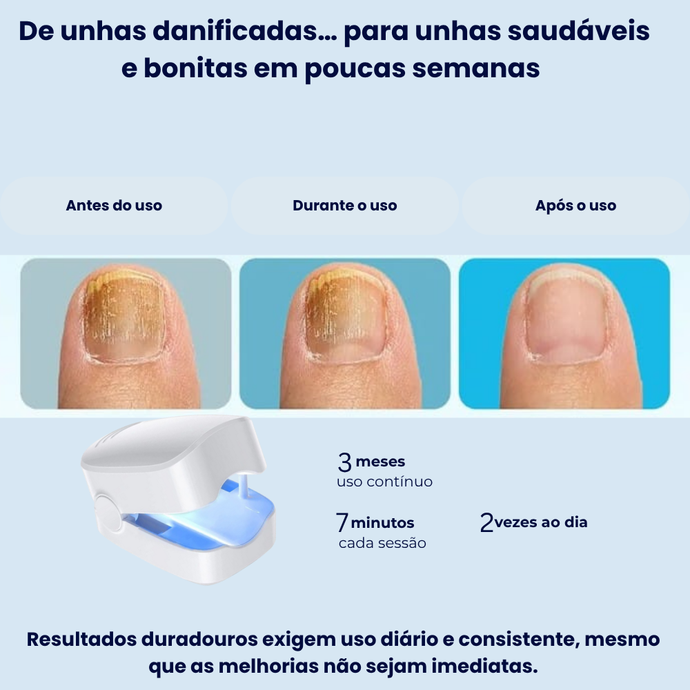 RenovaUnhas-Terapia de Luz Azul