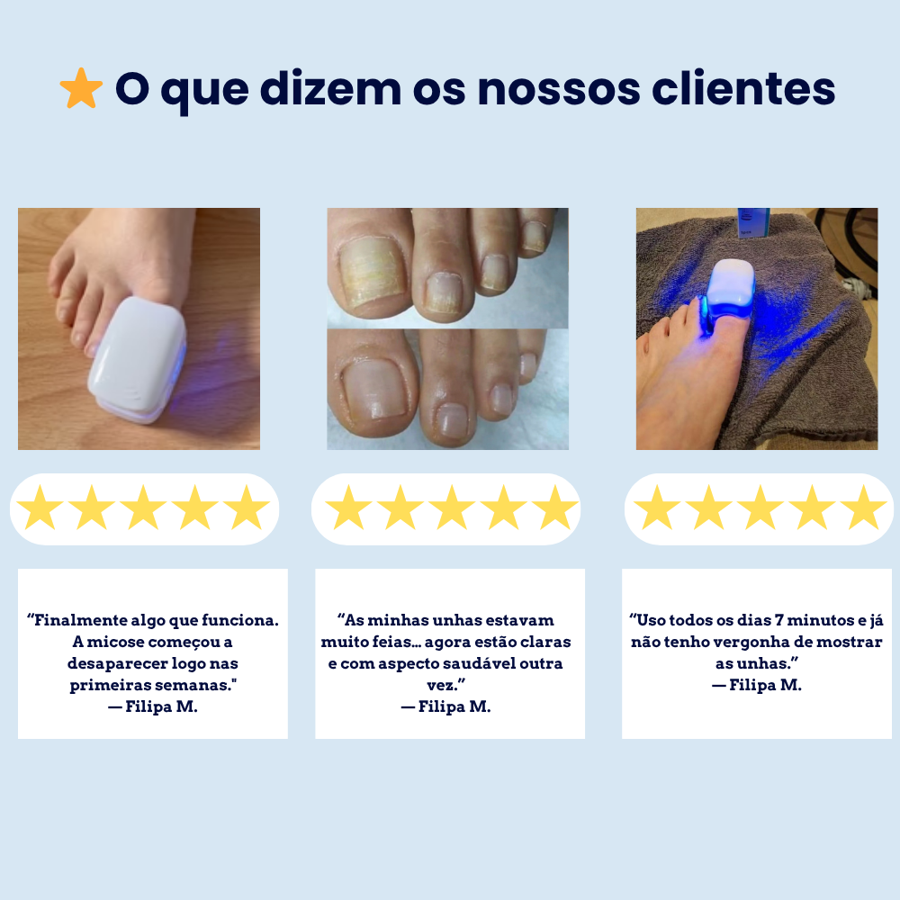 RenovaUnhas-Terapia de Luz Azul